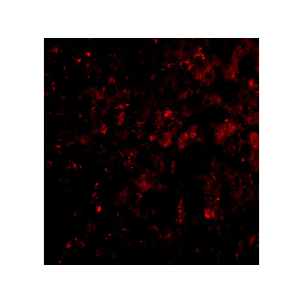 ProSci 4035 DRAM Antibody, ProSci, 0.1 mg/Unit Tertiary Image