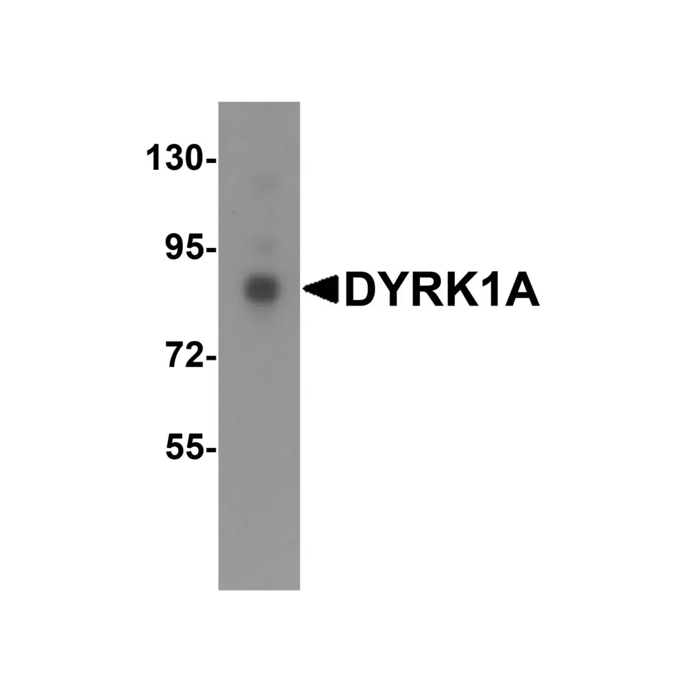 ProSci 6255 DYRK1A Antibody, ProSci, 0.1 mg/Unit Quaternary Image
