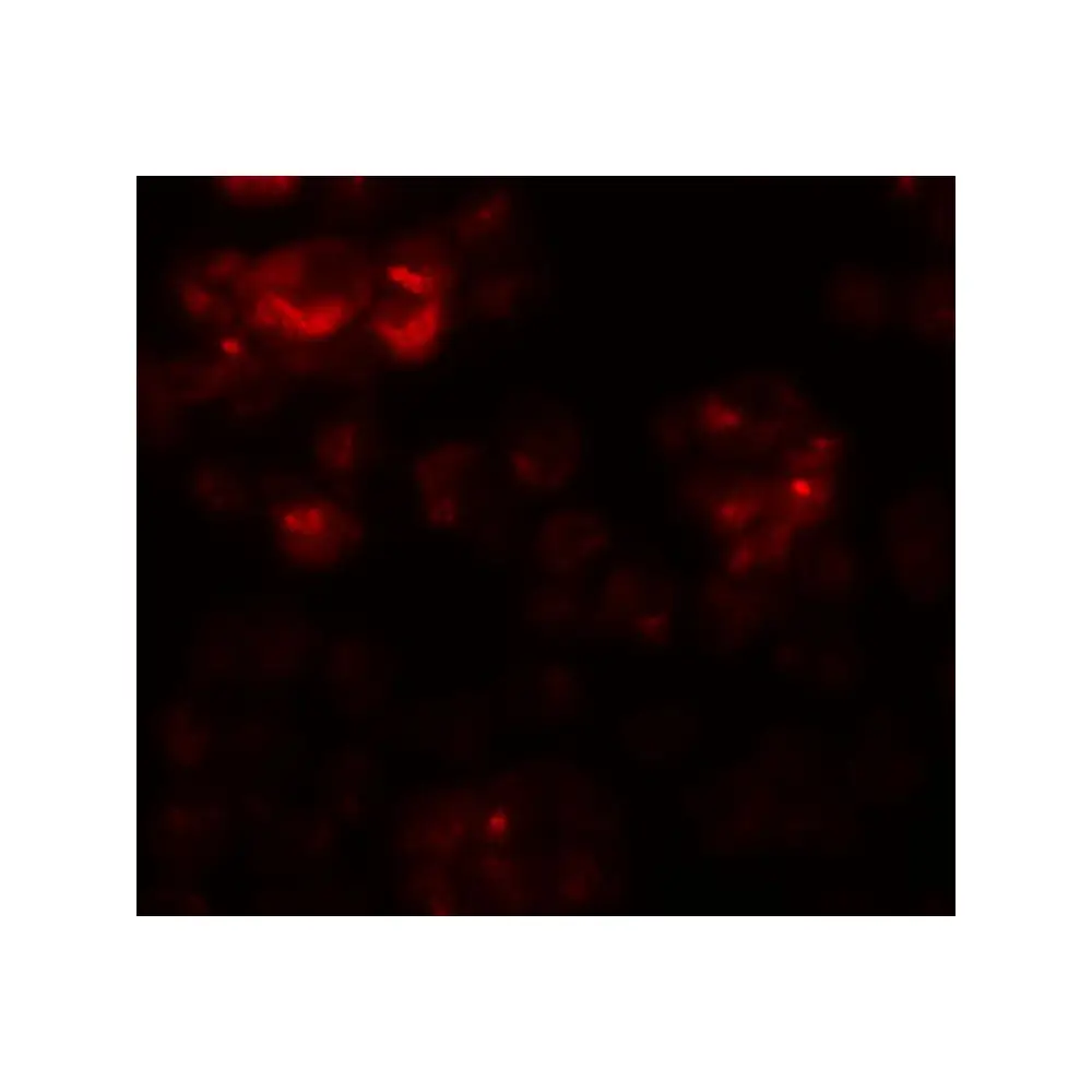 ProSci 6257 DYRK2 Antibody, ProSci, 0.1 mg/Unit Tertiary Image