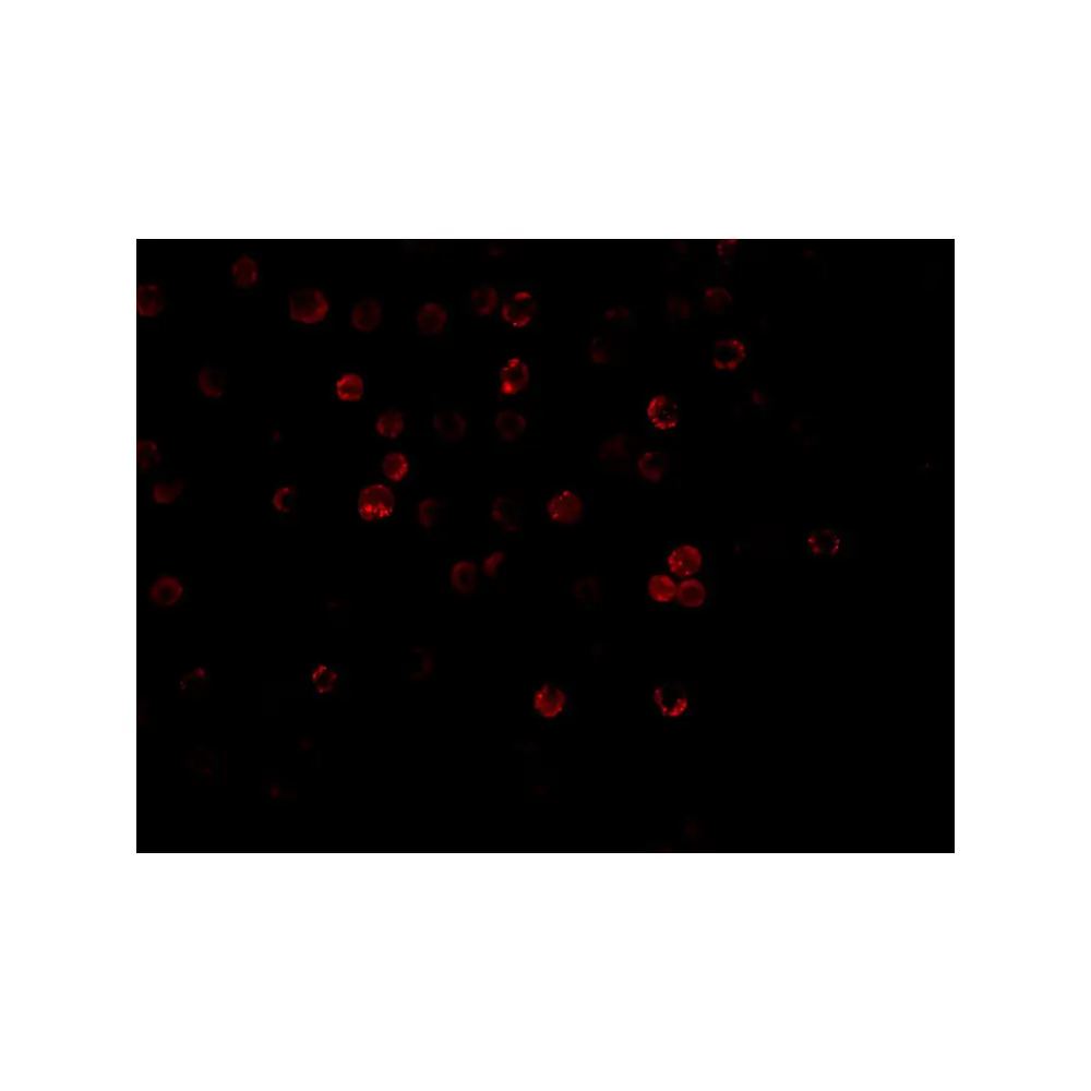 ProSci 2179 DcR1 Antibody, ProSci, 0.1 mg/Unit Tertiary Image