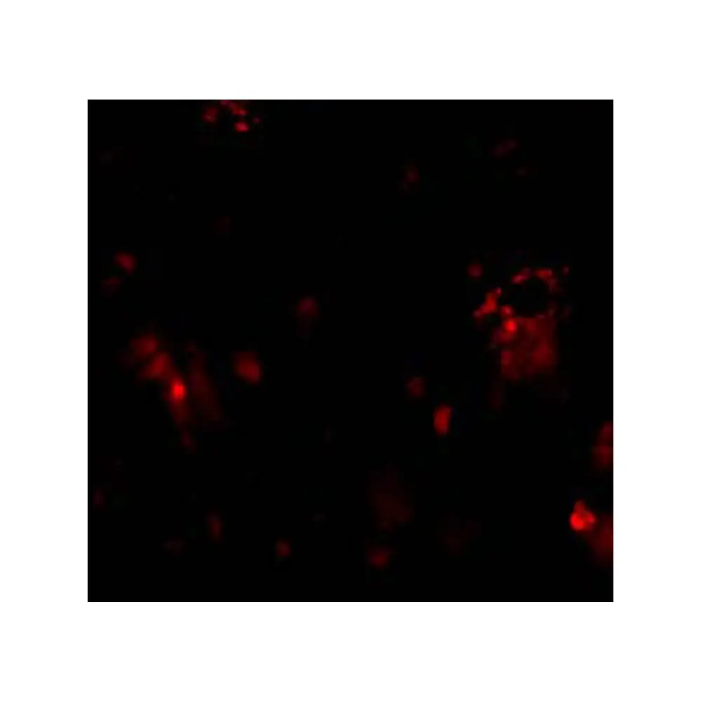 ProSci 2299 DcR1 Antibody, ProSci, 0.1 mg/Unit Secondary Image