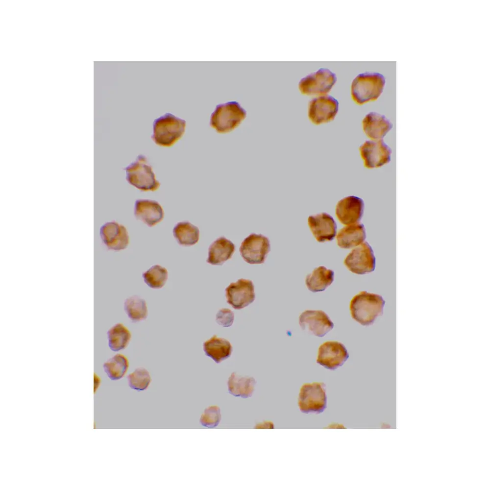 ProSci 2021_S DcR2 Antibody, ProSci, 0.02 mg/Unit Secondary Image