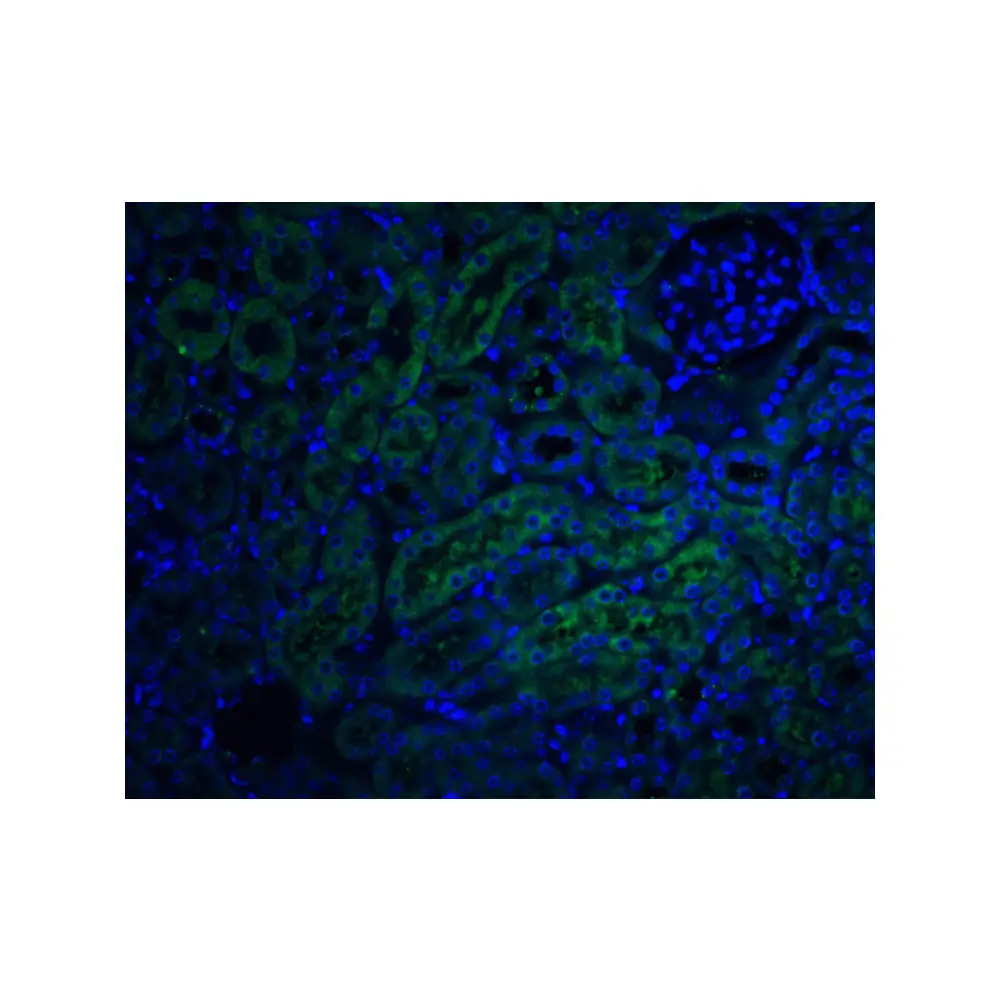 ProSci 2021 DcR2 Antibody, ProSci, 0.1 mg/Unit Quaternary Image