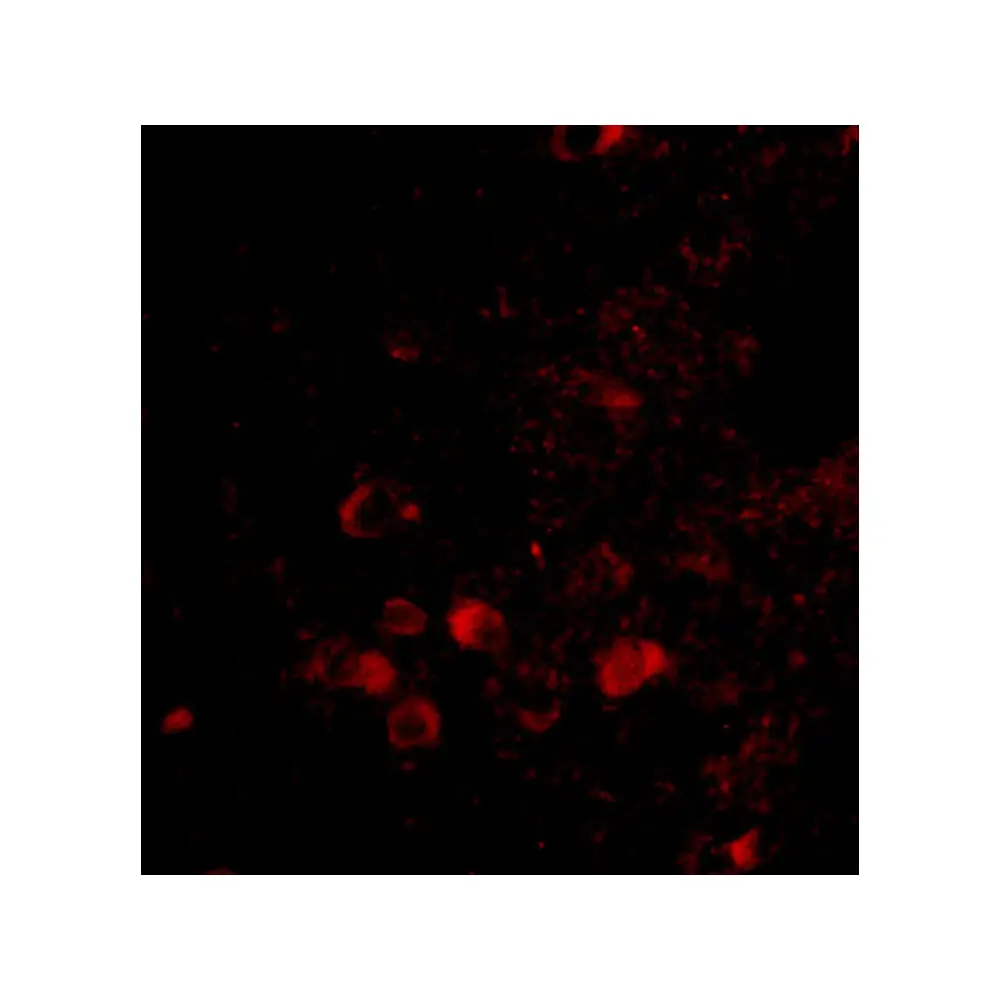 ProSci 4571_S ELOVL6 Antibody, ProSci, 0.02 mg/Unit Tertiary Image