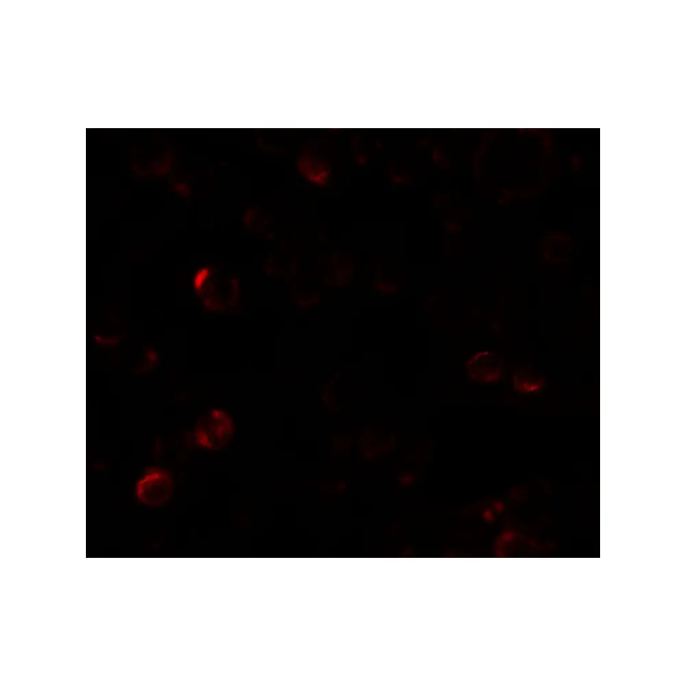 ProSci 7023_S EPM2A Antibody, ProSci, 0.02 mg/Unit Tertiary Image