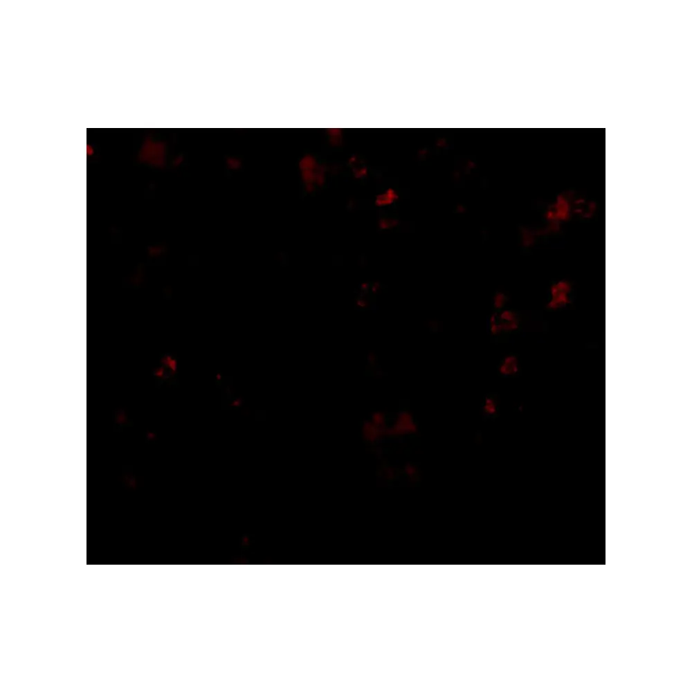ProSci 4549_S EVER1 Antibody, ProSci, 0.02 mg/Unit Tertiary Image