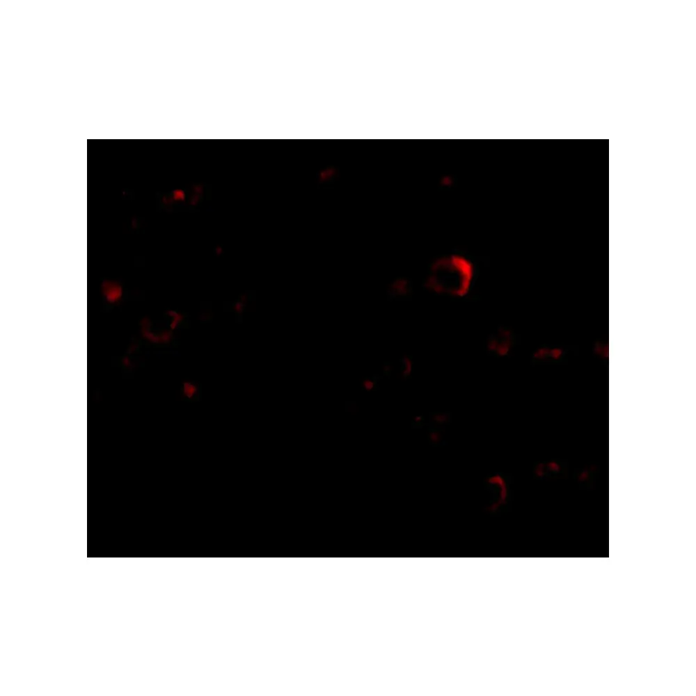 ProSci 4605 EVER2 Antibody, ProSci, 0.1 mg/Unit Tertiary Image