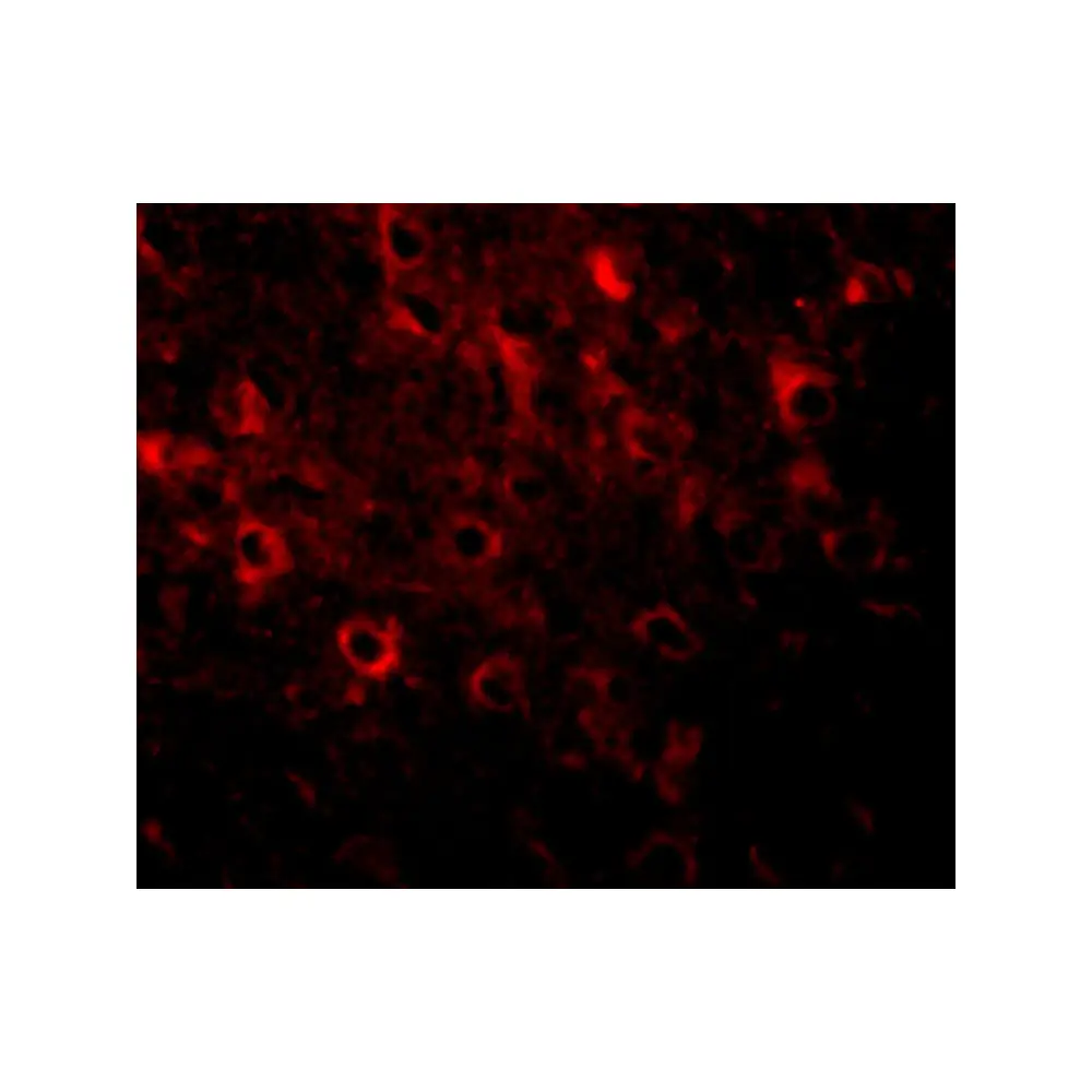 ProSci 5307 FAM120A Antibody, ProSci, 0.1 mg/Unit Tertiary Image
