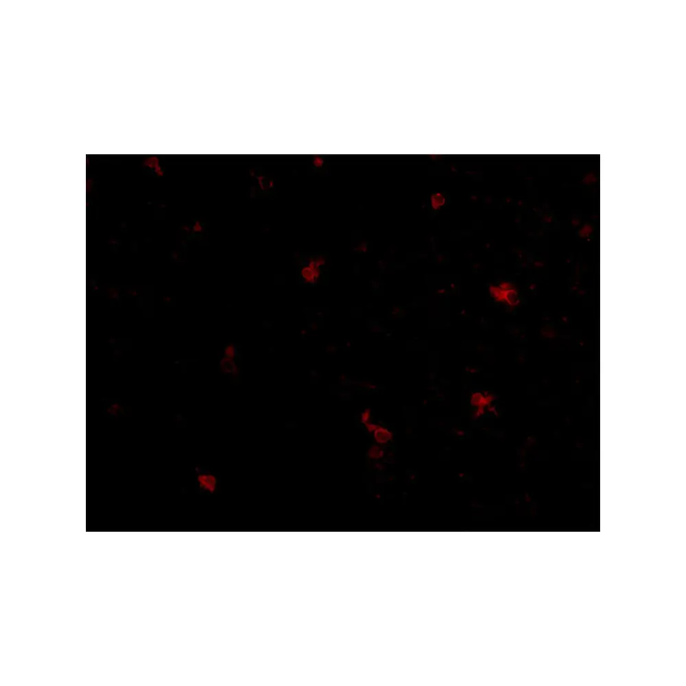 ProSci 4403 FEZ2 Antibody, ProSci, 0.1 mg/Unit Secondary Image