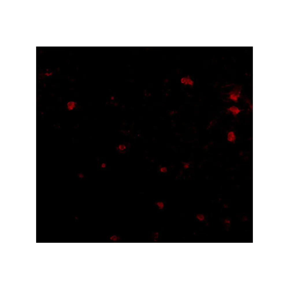 ProSci 4405 FEZ2 Antibody, ProSci, 0.1 mg/Unit Secondary Image