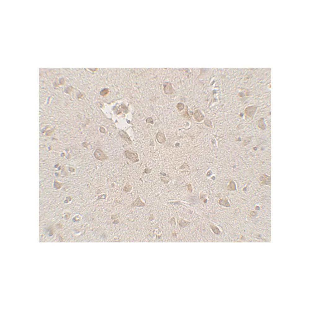 ProSci 7707 FMR1 Antibody, ProSci, 0.1 mg/Unit Secondary Image