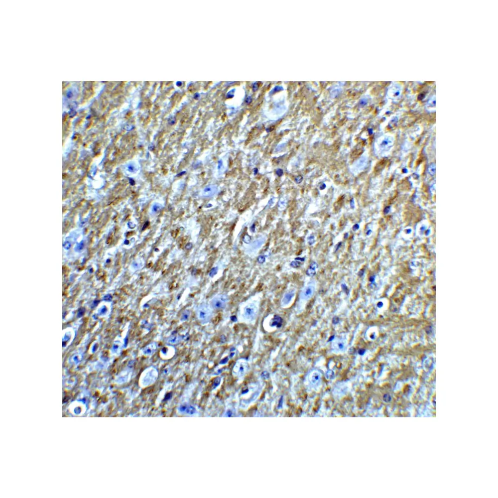 ProSci 7257 FOXA2 Antibody, ProSci, 0.1 mg/Unit Tertiary Image