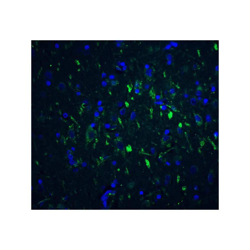 ProSci 7187 FOXP3 Antibody, ProSci, 0.1 mg/Unit Tertiary Image