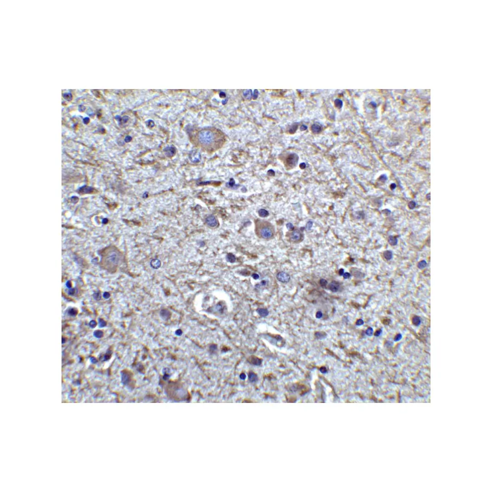 ProSci 7187_S FOXP3 Antibody, ProSci, 0.02 mg/Unit Secondary Image