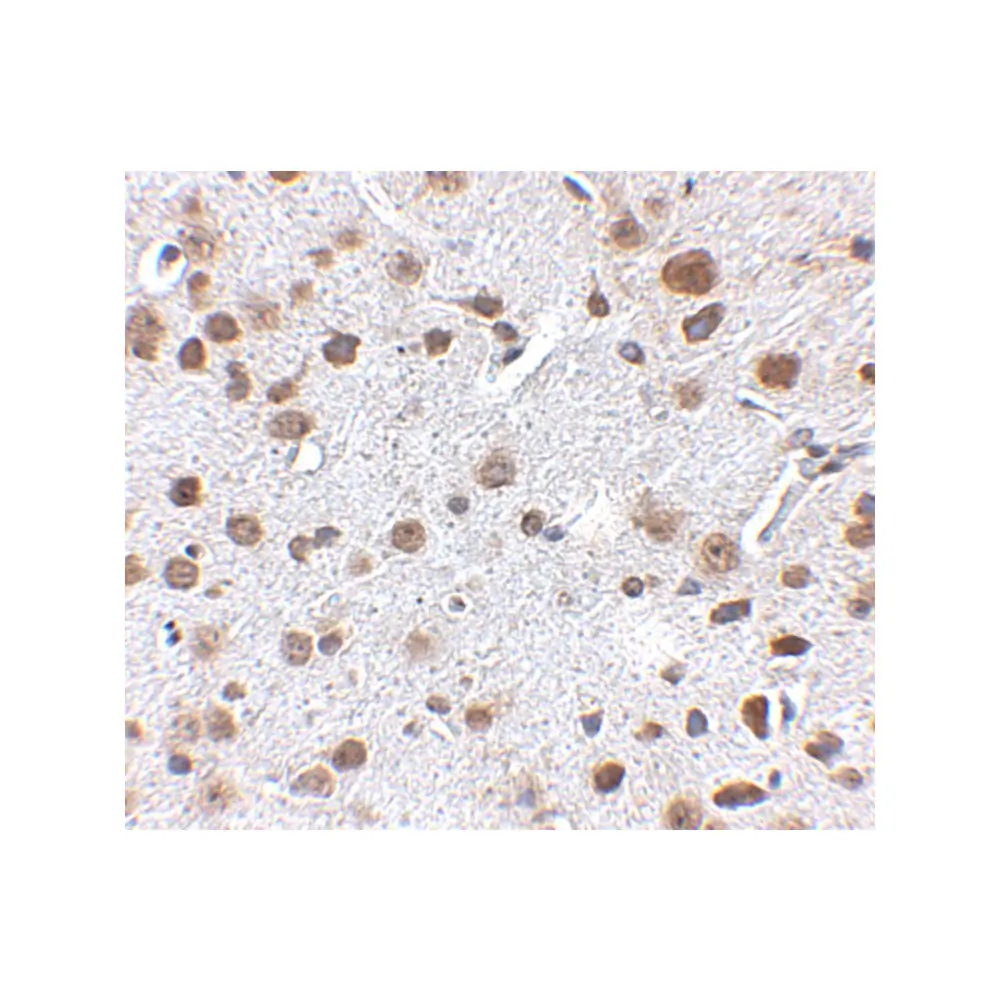 ProSci 5137 FTO Antibody, ProSci, 0.1 mg/Unit Primary Image
