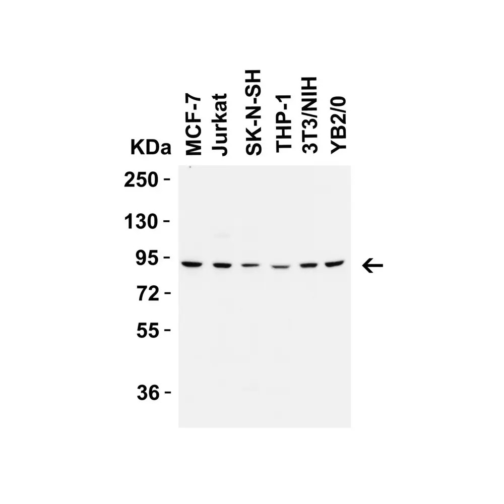 ProSci 9551 FZD6 (IN) Antibody, ProSci, 0.1 mg/Unit Primary Image