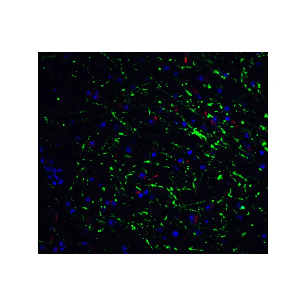 ProSci 7359_S GABARAP Antibody, ProSci, 0.02 mg/Unit Quaternary Image