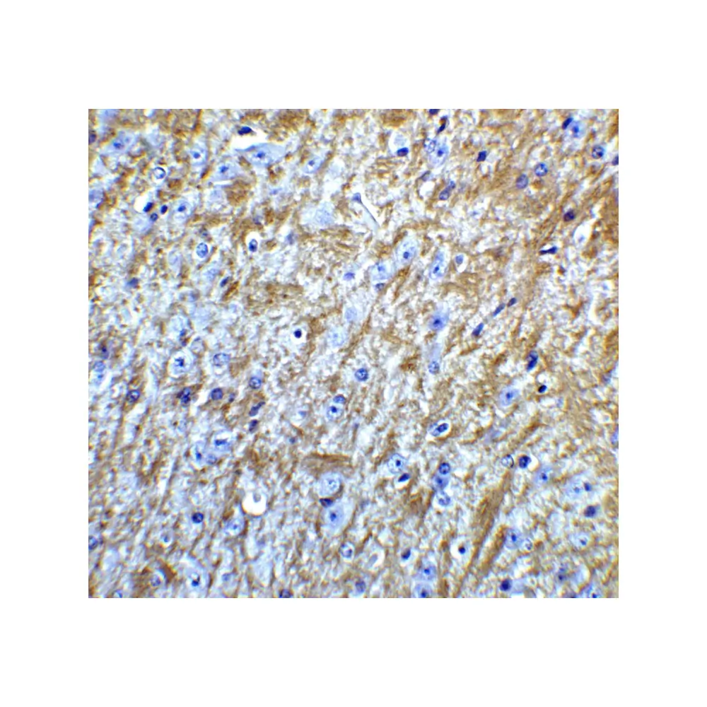 ProSci 7359 GABARAP Antibody, ProSci, 0.1 mg/Unit Tertiary Image