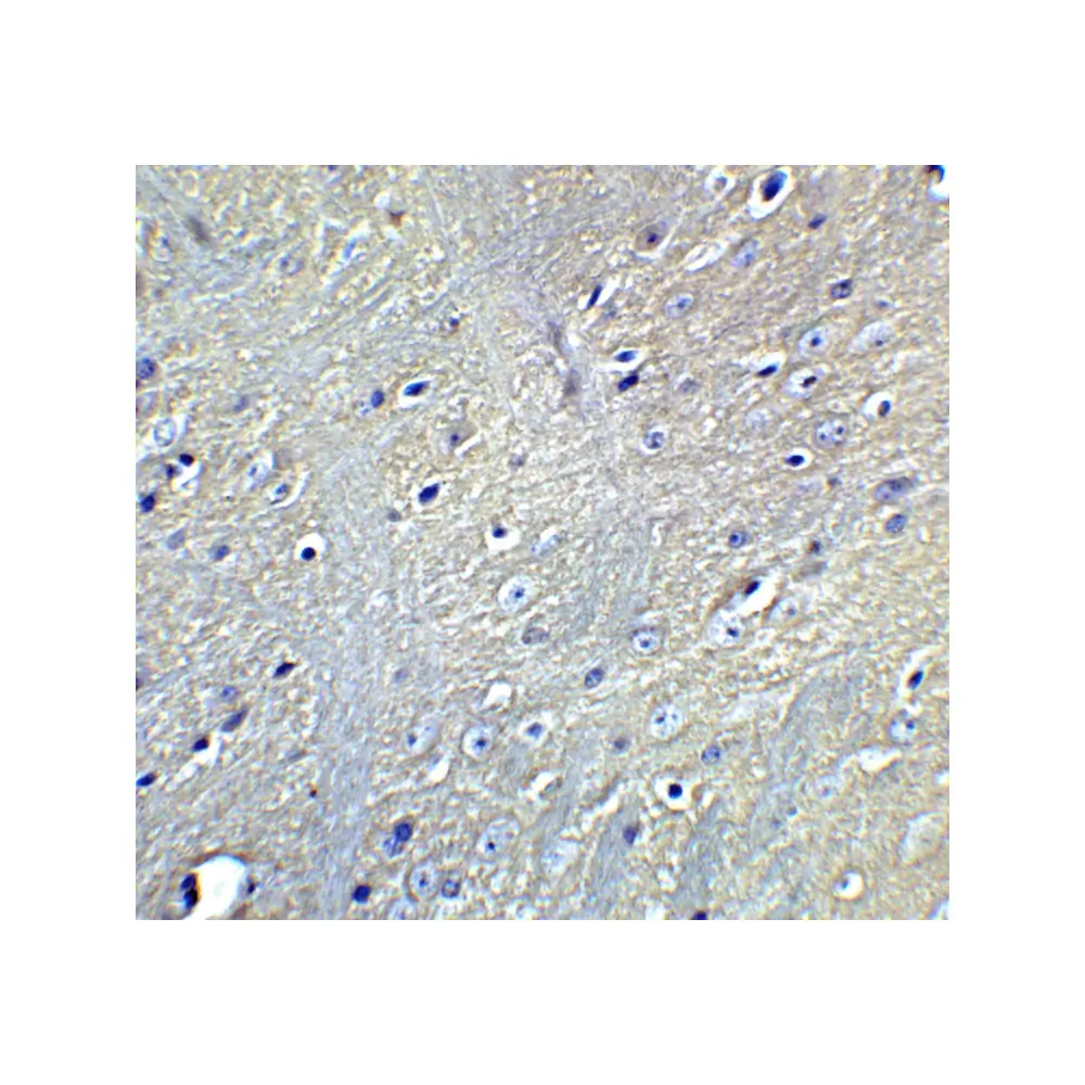 ProSci 7895_S GABARAPL2 Antibody, ProSci, 0.02 mg/Unit Quaternary Image