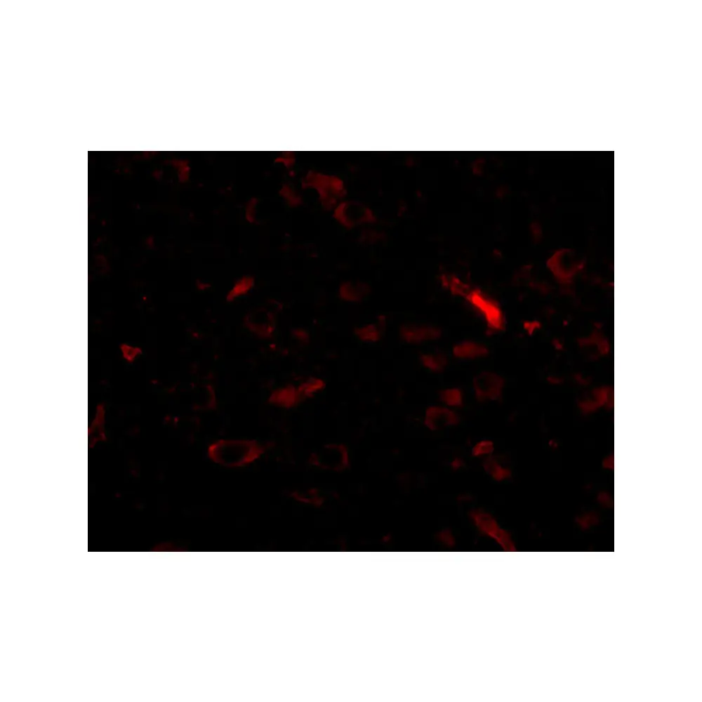 ProSci 5279_S GALNT10 Antibody, ProSci, 0.02 mg/Unit Tertiary Image