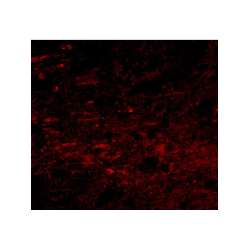 ProSci 5281_S GALNT10 Antibody, ProSci, 0.02 mg/Unit Tertiary Image
