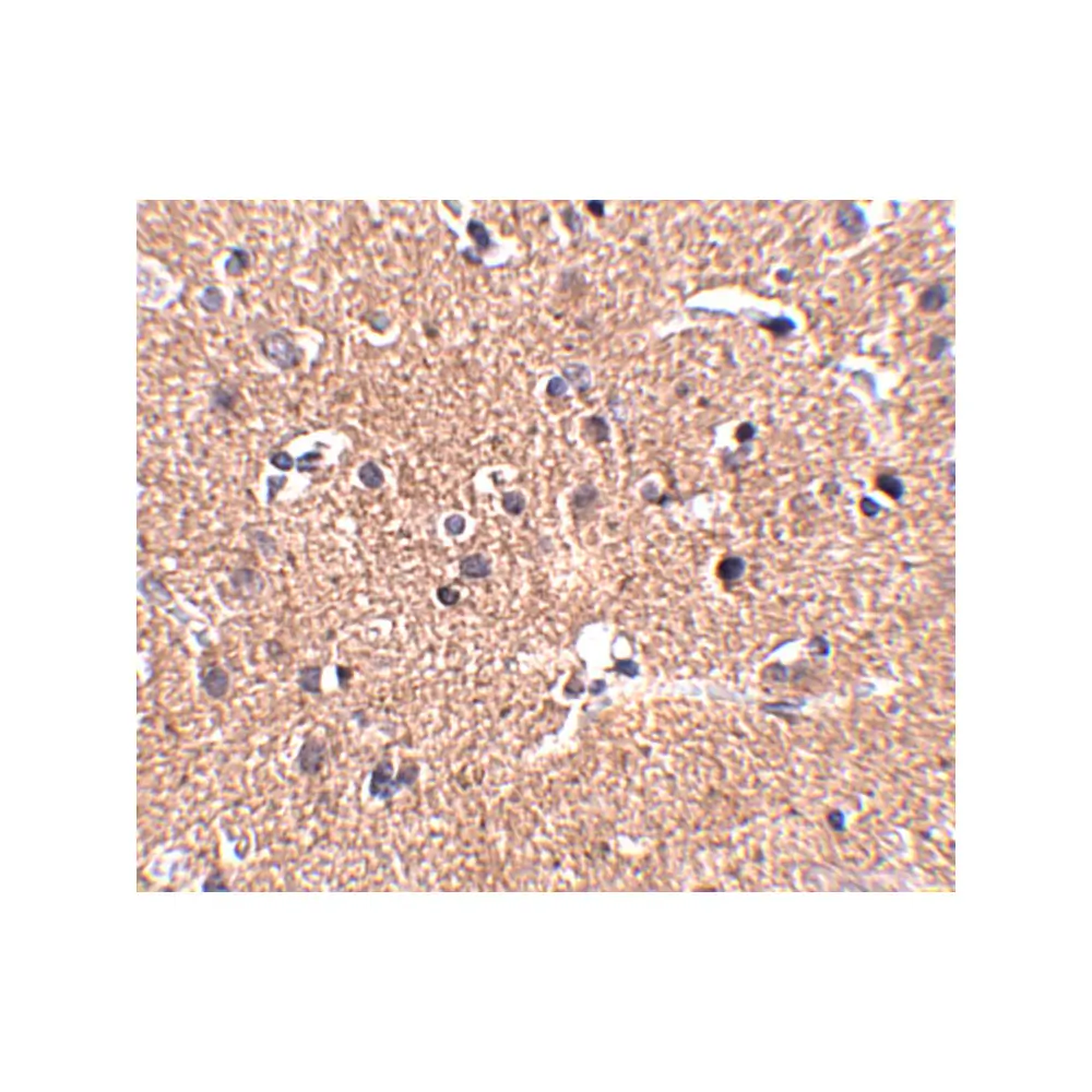 ProSci 5281_S GALNT10 Antibody, ProSci, 0.02 mg/Unit Secondary Image
