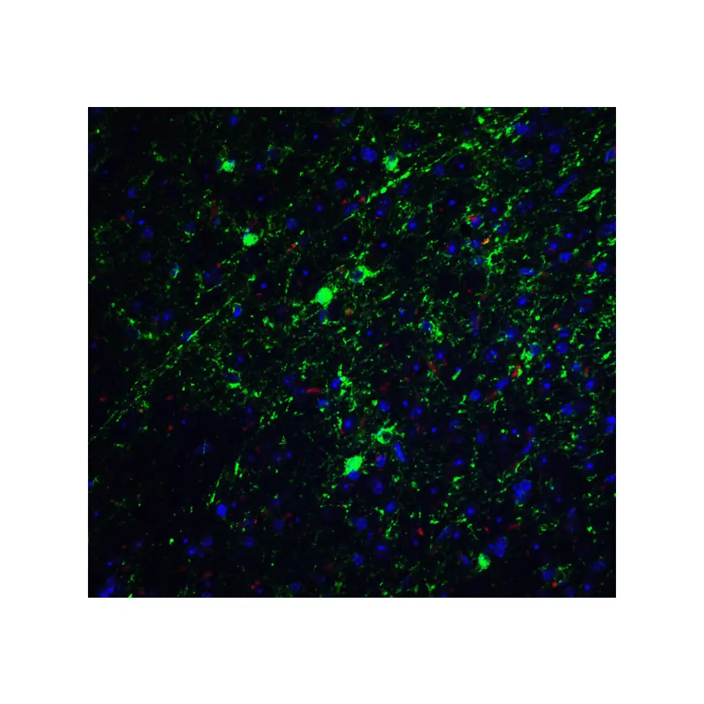 ProSci PM-7209 GLUL Monoclonal Antibody, ProSci, 0.1 mg/Unit Tertiary Image