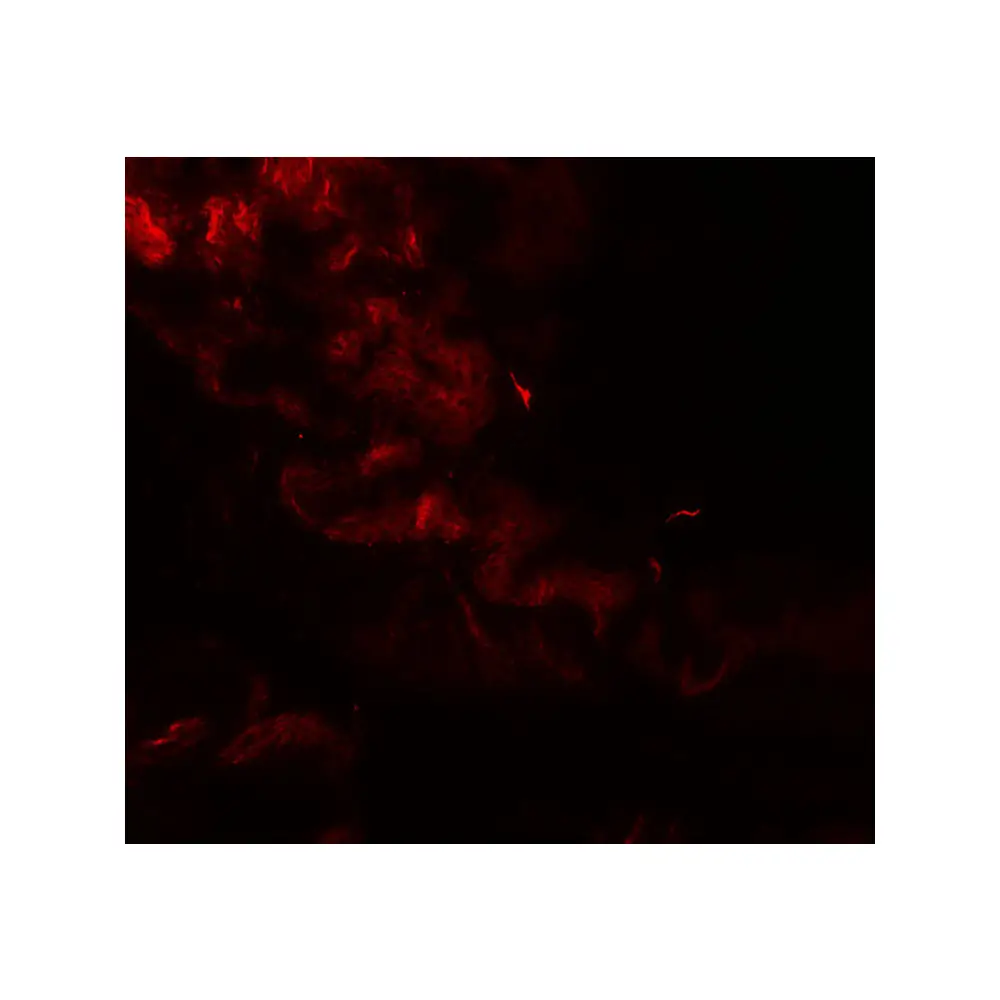 ProSci 8215_S GOLGIN97 Antibody, ProSci, 0.02 mg/Unit Tertiary Image
