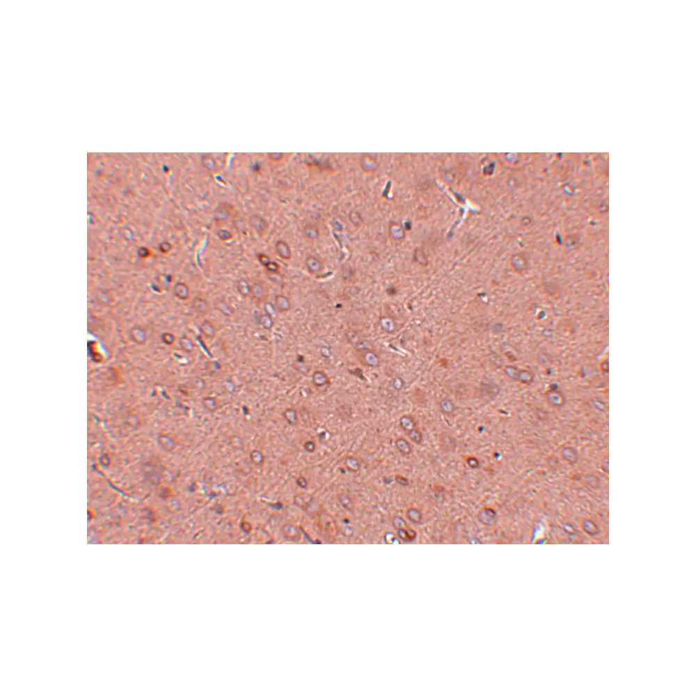 ProSci 5441 GOLPH2 Antibody, ProSci, 0.1 mg/Unit Secondary Image