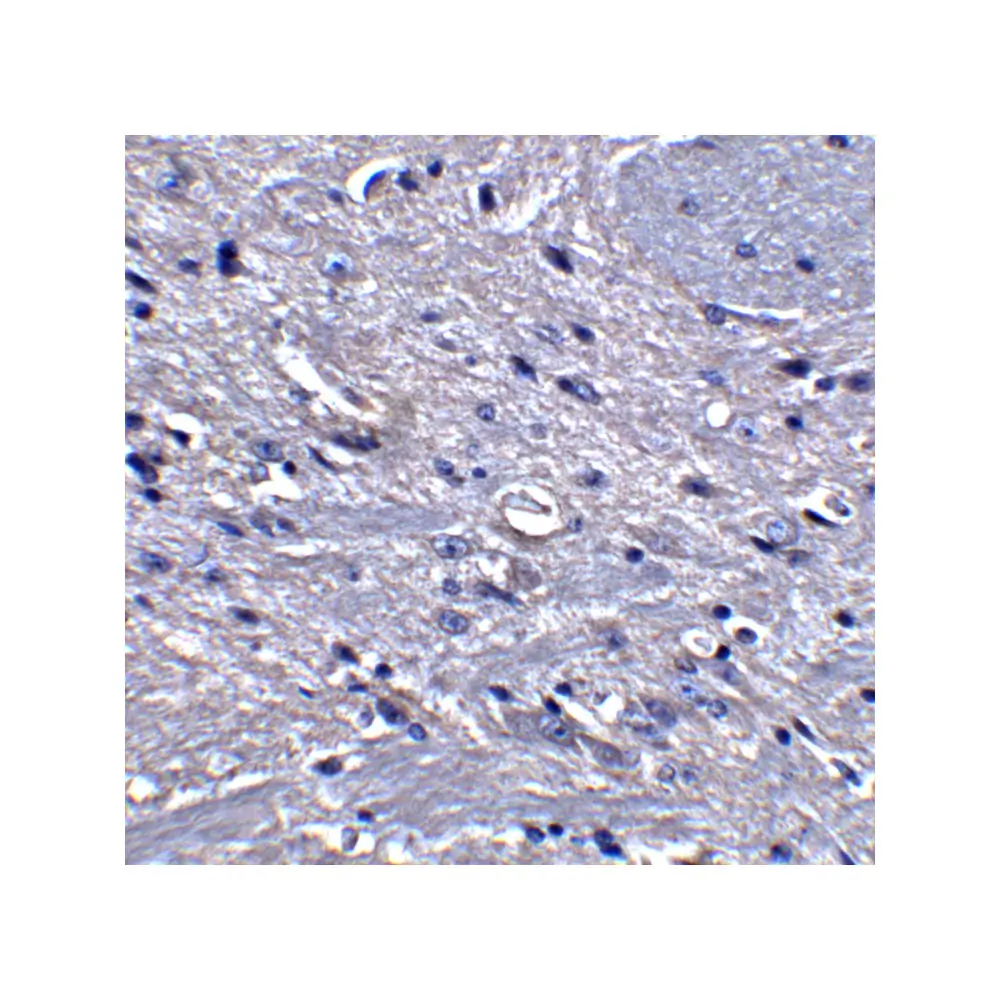 ProSci 4613 GPAT1 Antibody, ProSci, 0.1 mg/Unit Quaternary Image