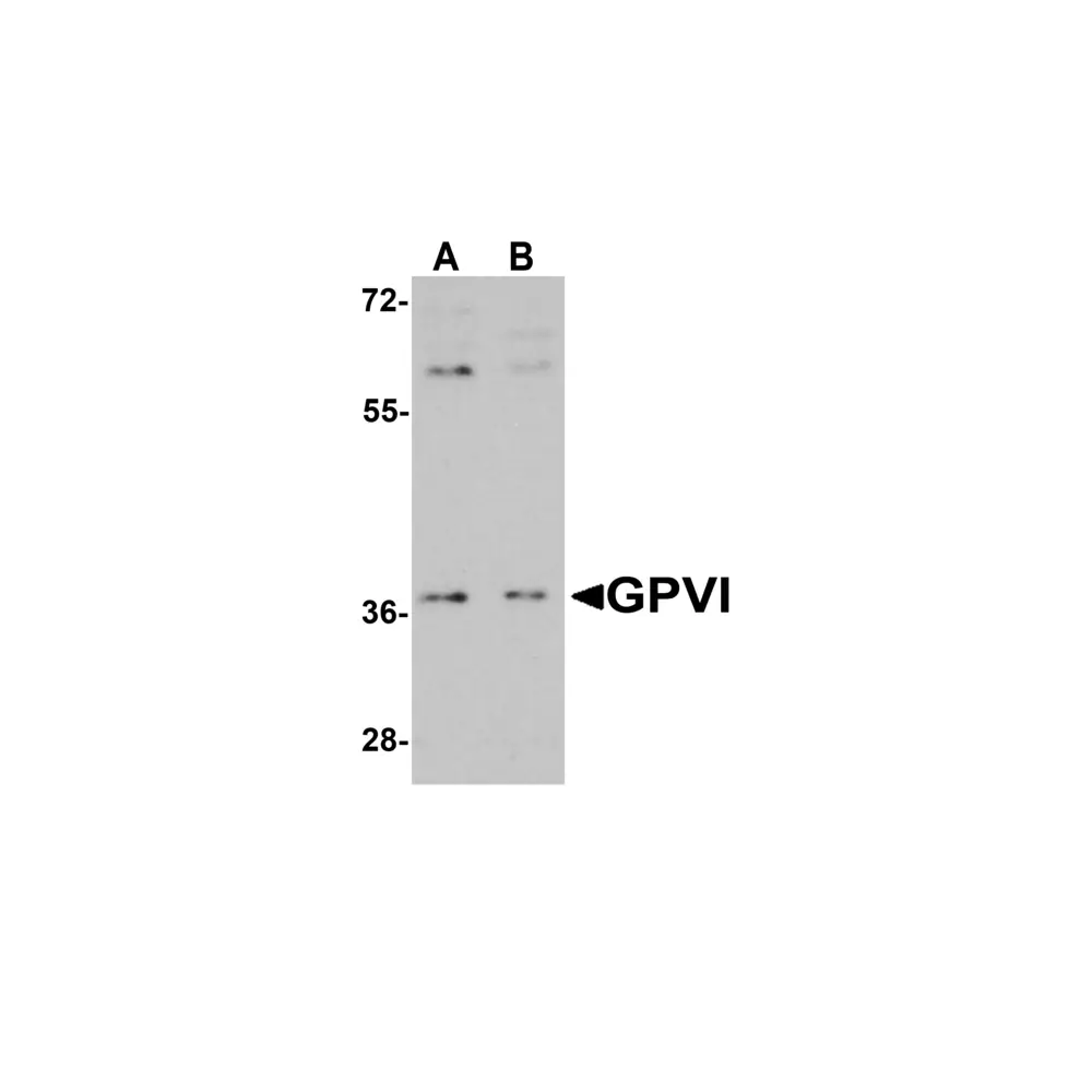 ProSci 4769_S GPVI Antibody, ProSci, 0.02 mg/Unit Quaternary Image