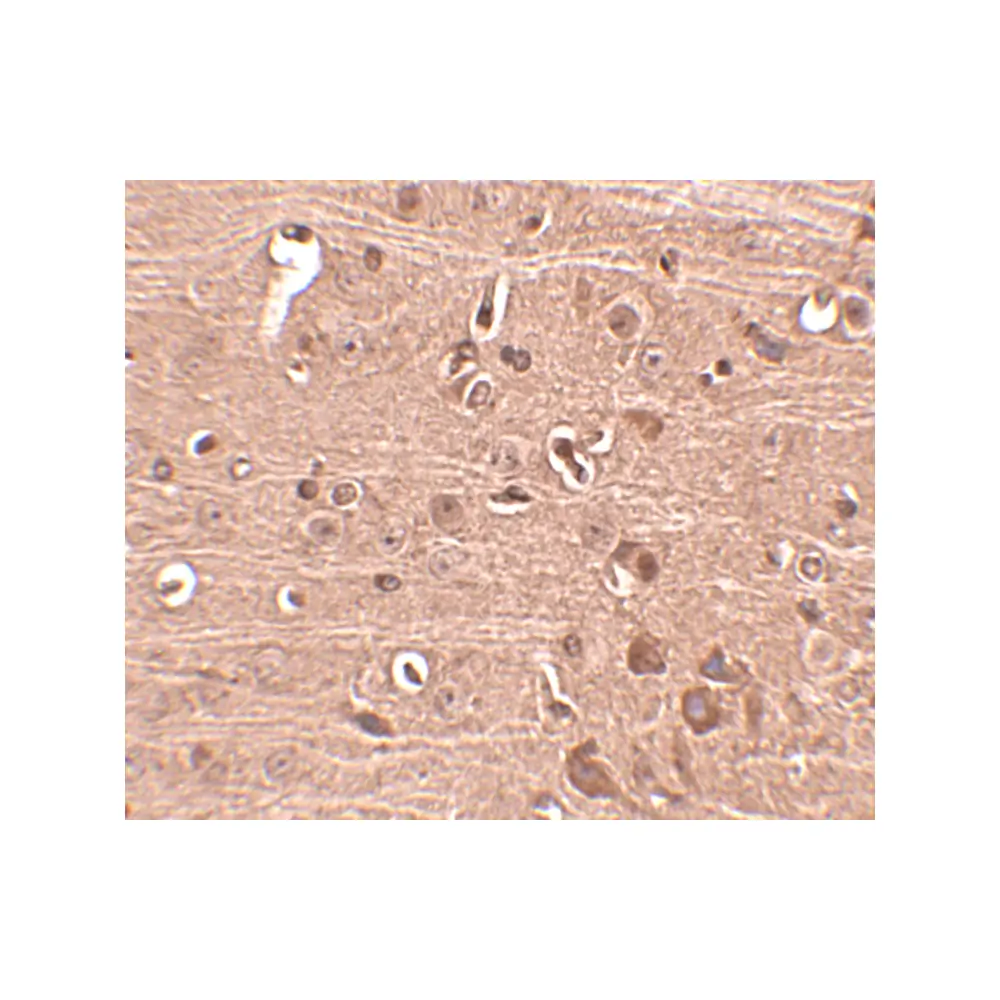 ProSci 4963 Gle1 Antibody, ProSci, 0.1 mg/Unit Secondary Image