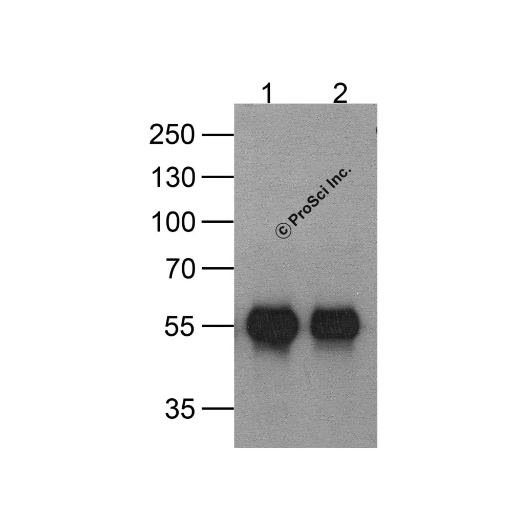 ProSci PM-7663 HAT-tag Antibody [9A2F8], ProSci, 0.1 mg/Unit Secondary Image