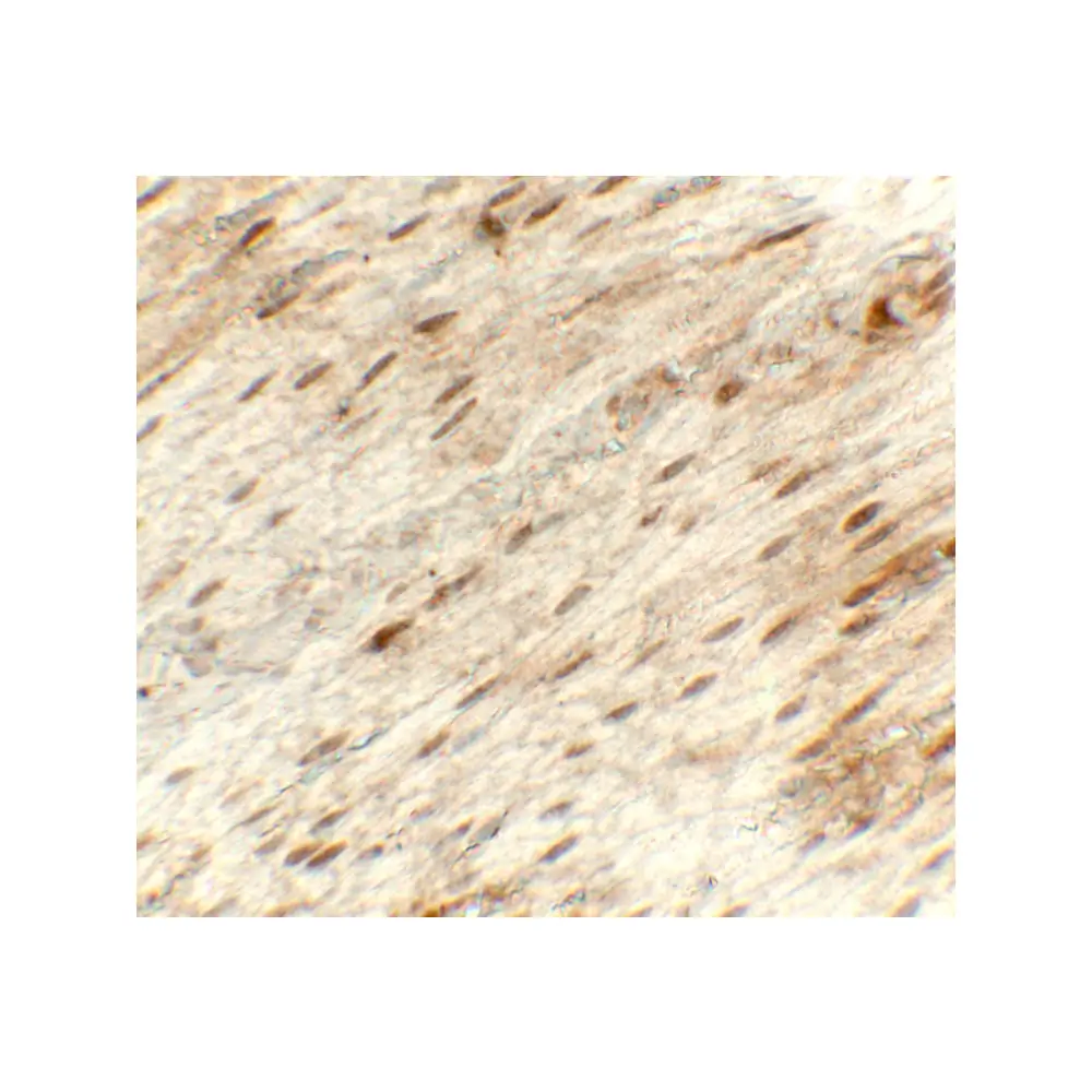 ProSci 8217_S Hexokinase 1 Antibody, ProSci, 0.02 mg/Unit Secondary Image