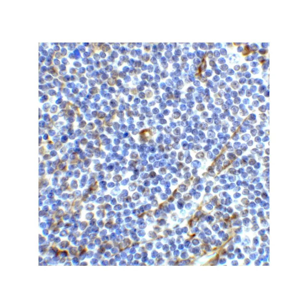 ProSci 8685_S ICOS Antibody, ProSci, 0.02 mg/Unit Primary Image