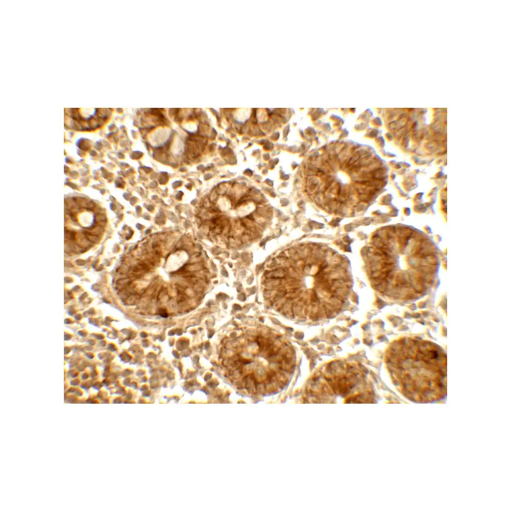 ProSci 7757_S IFIT1 Antibody, ProSci, 0.02 mg/Unit Secondary Image
