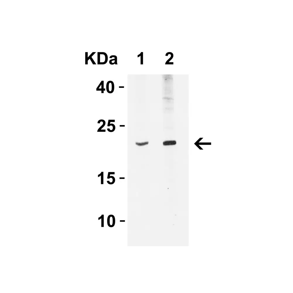 ProSci 4243_S IFN-beta Antibody, ProSci, 0.02 mg/Unit Primary Image
