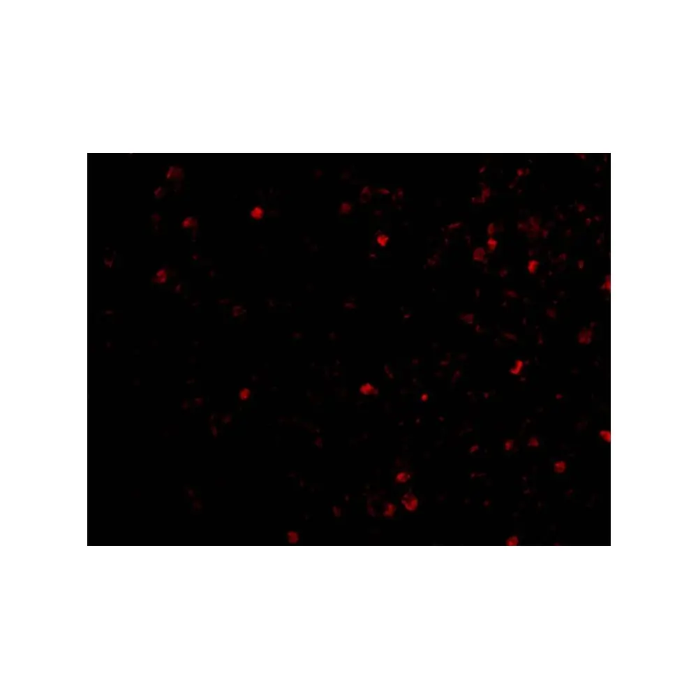ProSci 2337 IKAP Antibody, ProSci, 0.1 mg/Unit Tertiary Image