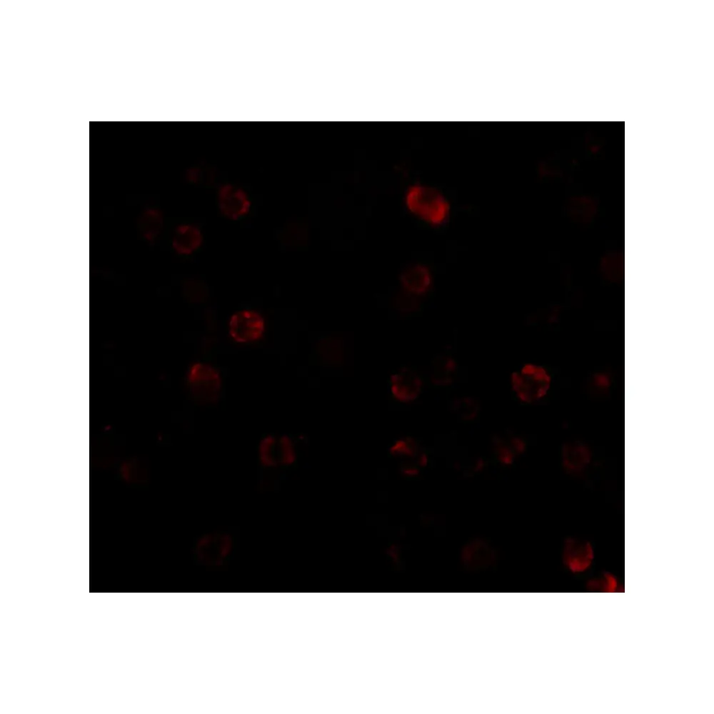 ProSci 2115 IKK alpha Antibody, ProSci, 0.1 mg/Unit Tertiary Image