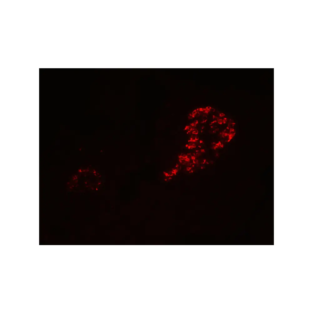 ProSci 7497_S IL-12A Antibody, ProSci, 0.02 mg/Unit Tertiary Image