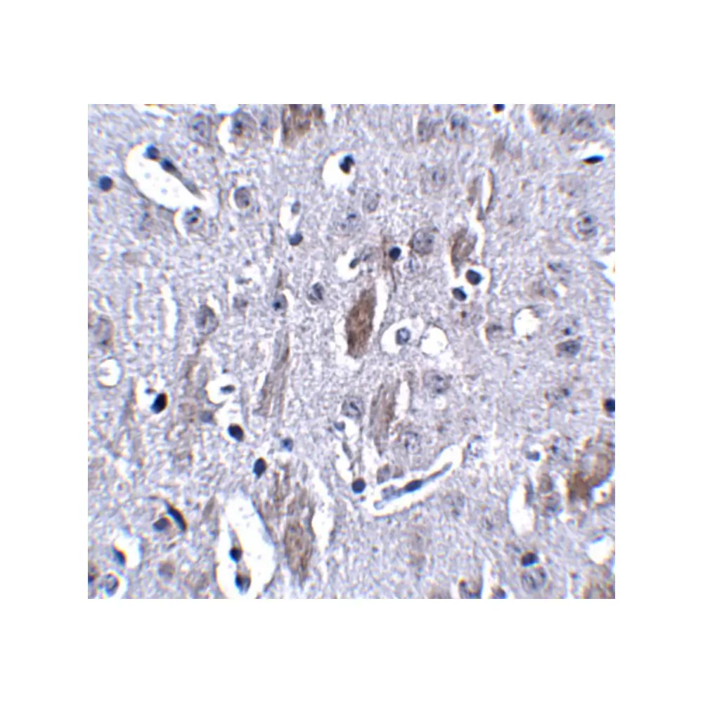 ProSci 4995 IL-16 Antibody, ProSci, 0.1 mg/Unit Secondary Image