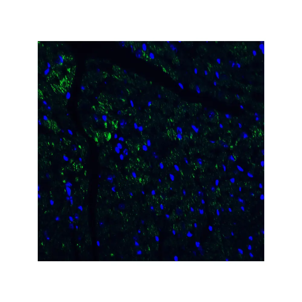 ProSci 4887_S IL-17 Antibody, ProSci, 0.02 mg/Unit Quaternary Image