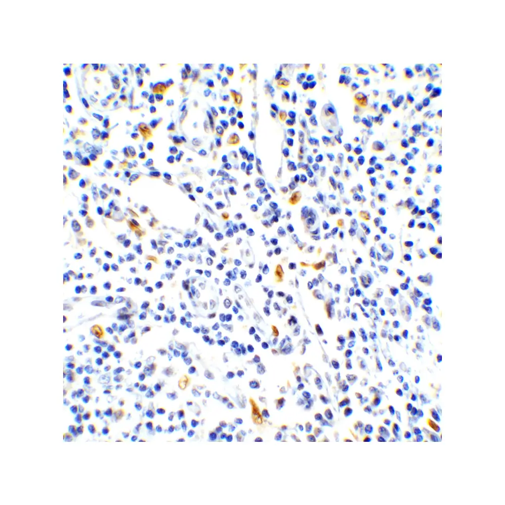 ProSci 4887_S IL-17 Antibody, ProSci, 0.02 mg/Unit Tertiary Image