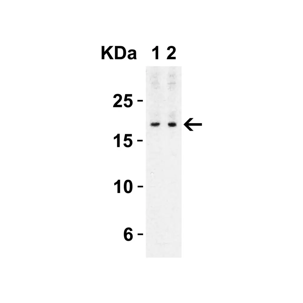 ProSci 4887_S IL-17 Antibody, ProSci, 0.02 mg/Unit Secondary Image