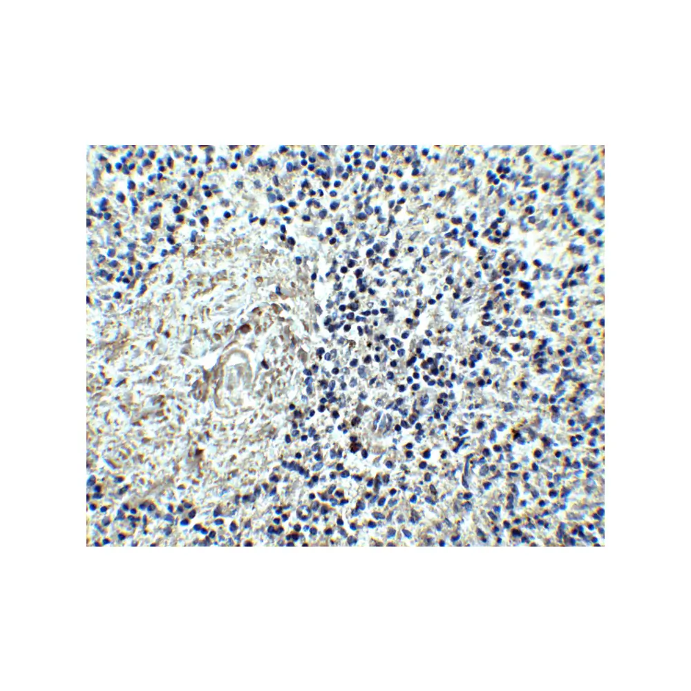 ProSci 7419 IL-17RA Antibody, ProSci, 0.1 mg/Unit Secondary Image