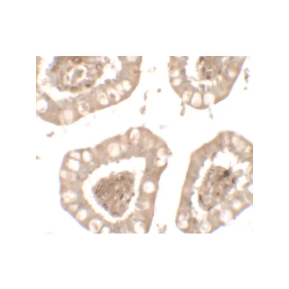 ProSci 7501_S IL-1RL2 Antibody, ProSci, 0.02 mg/Unit Secondary Image
