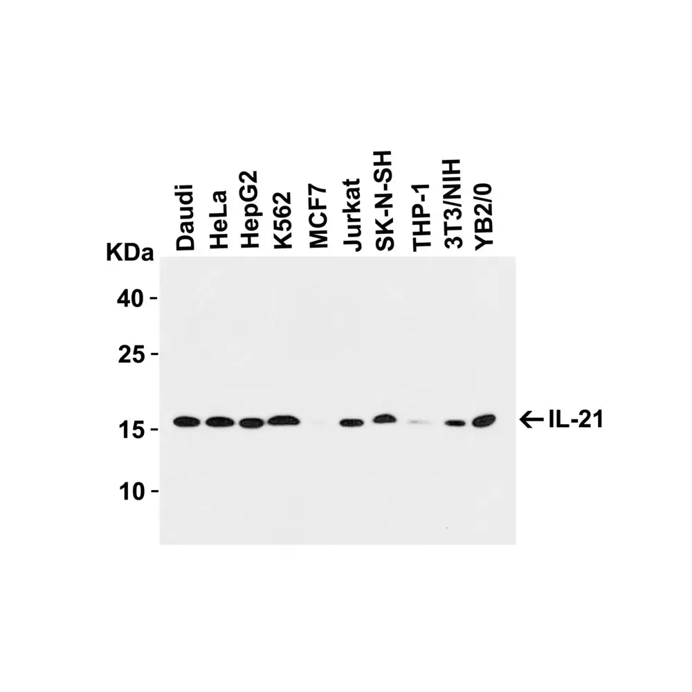 ProSci 2465 IL-21 Antibody, ProSci, 0.1 mg/Unit Primary Image