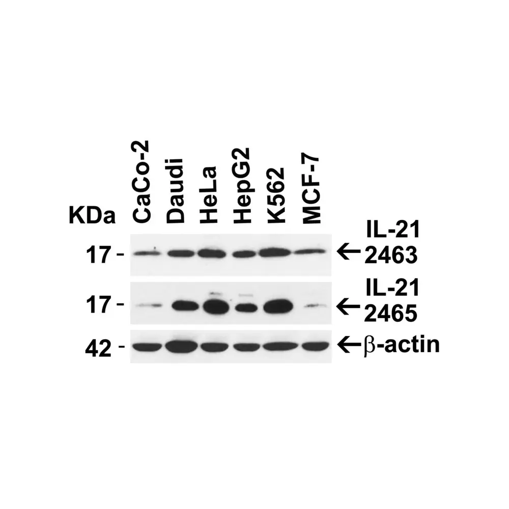 ProSci 2465_S IL-21 Antibody, ProSci, 0.02 mg/Unit Secondary Image