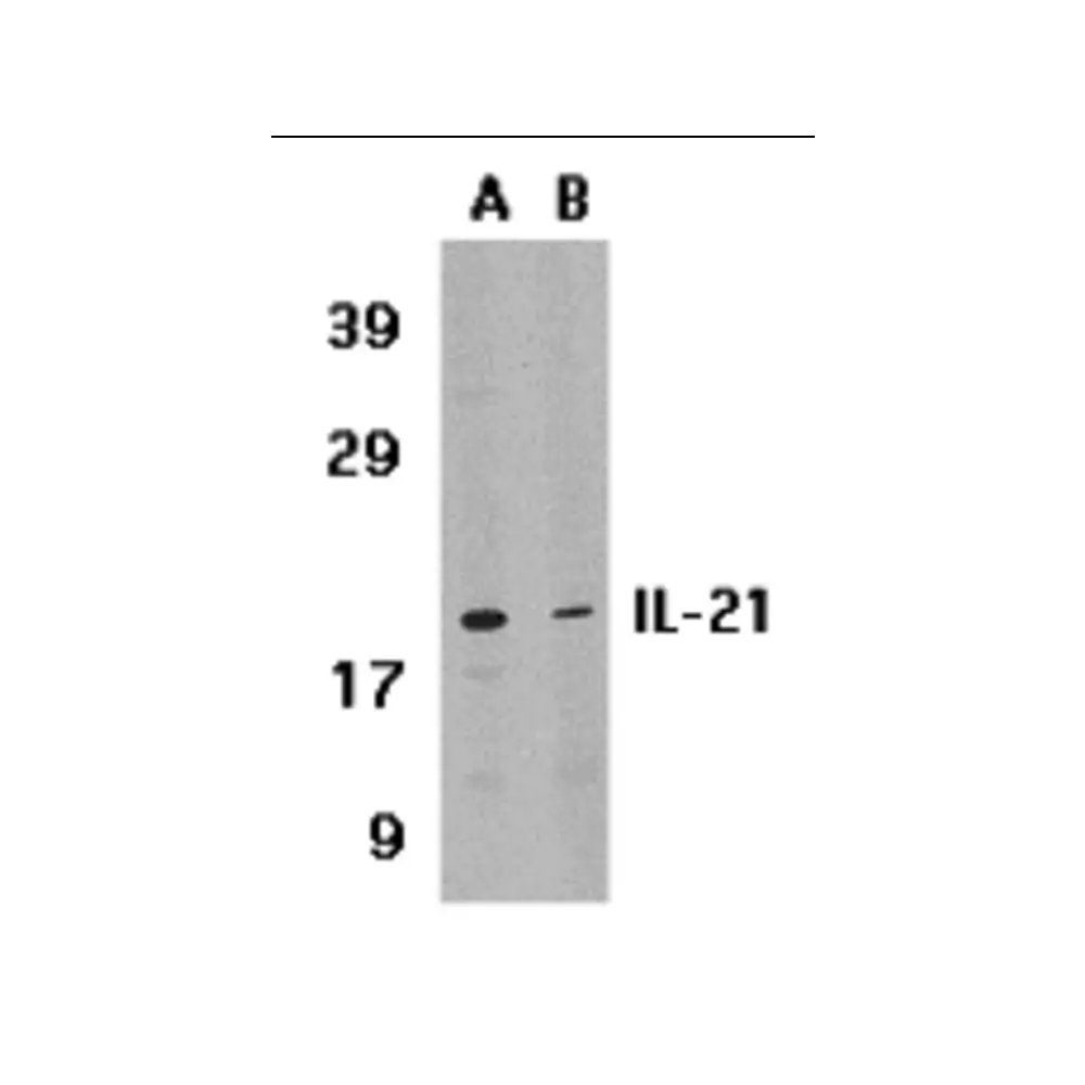 ProSci 2465_S IL-21 Antibody, ProSci, 0.02 mg/Unit Tertiary Image
