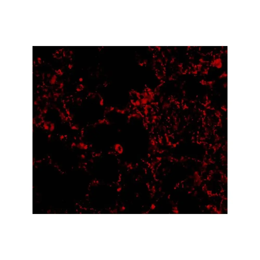 ProSci 2469 IL-21 Receptor Antibody, ProSci, 0.1 mg/Unit Tertiary Image